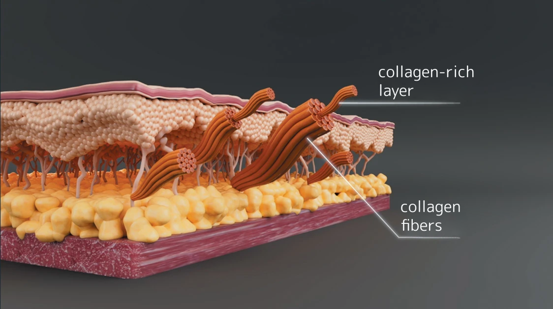 kuidas see toimib foto